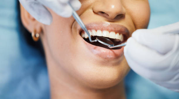Best Emergency Dental Extractions in Williston, FL